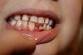 IMG_8575