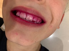IMG_2963
