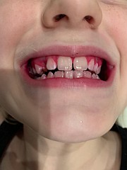 IMG_2964