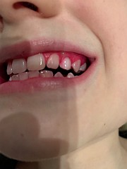 IMG_2965