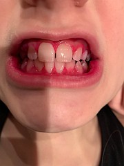 IMG_2973